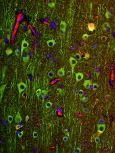 Immunofluorescence image of brain tissue. (Image: Erica Cecchini).