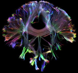 Nerve pathways in the brain, captured with diffusion tensor imaging. (Image: Prof. Dr. Frederik Laun).