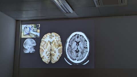 Impressions from the EBM Harmonization Workshop on Neuroimaging (Image: S. Kuth)